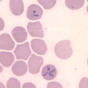 Babesia microti CDC microscopy - thin blood smear showing intraerythrocytic parasites