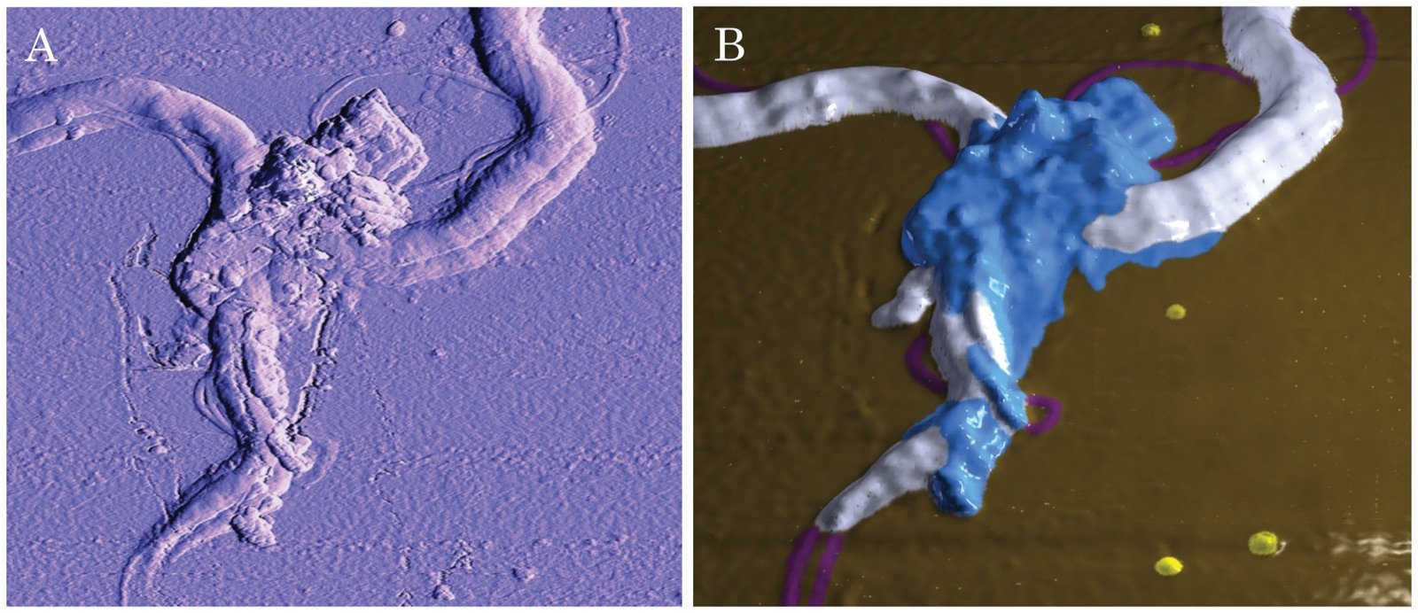 Borrelia burgdorferi biofilm at high magnification showing round body/cyst forms embedded in biofilm matrix — from Sapi et al. 2012 PLoS One