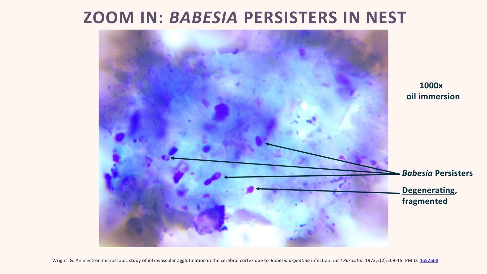 Lindner presentation slide showing high-magnification Babesia persister forms in a suspected nest fragment
