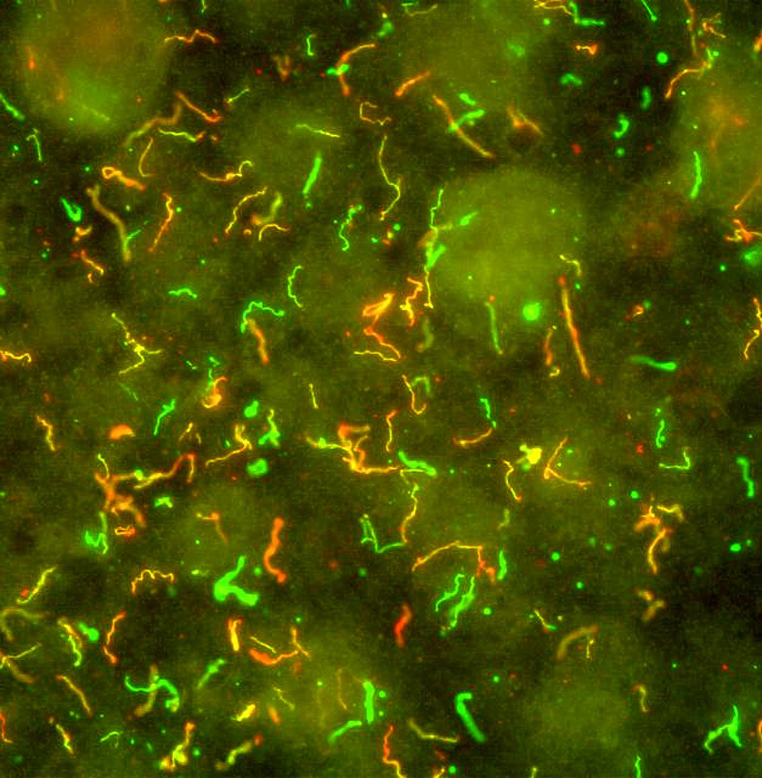 High-resolution Borrelia burgdorferi microscopy image — illustration of advanced diagnostic imaging